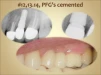 Almitech (4.1) - 4